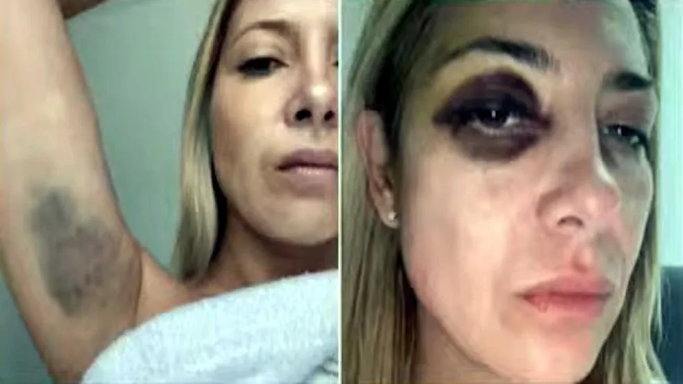 fabiola-yanez-golpeada-20240808-1850994