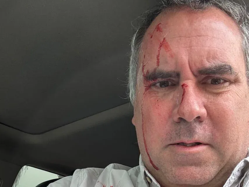 Candidato_Peru_Atentado-e1764695420258